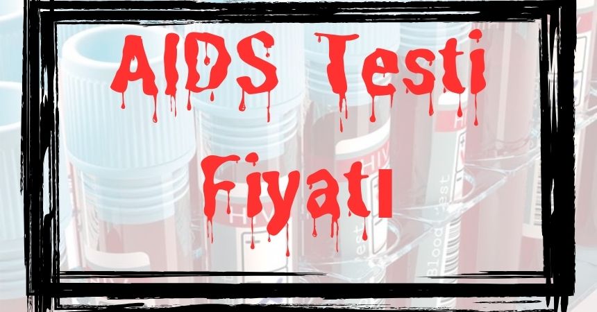Aids Testi Fiyatı