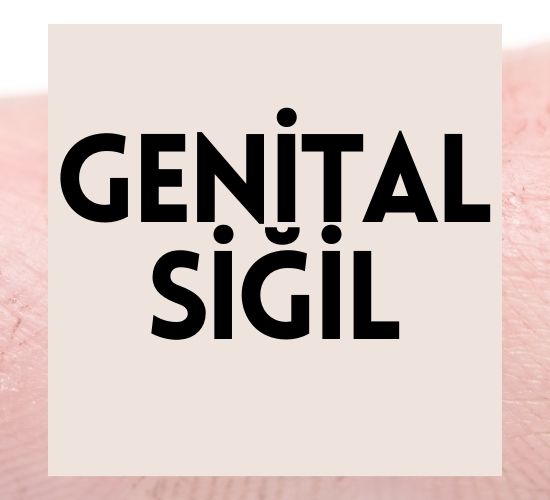 Genital Siğil