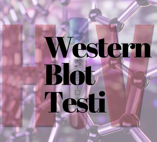 Western Blot Testi