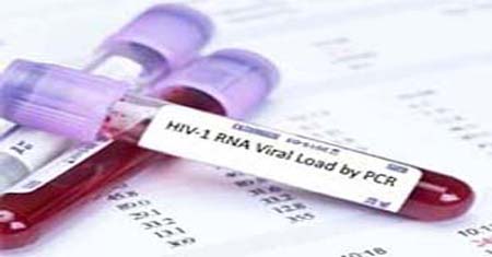 Hiv RNA PCR Testi
